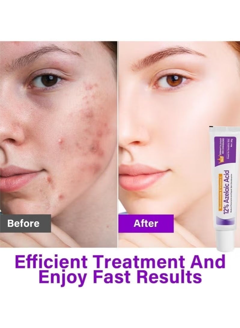 HTKCRX Azelaic Acid Serum, 12% Azelaic Acid, Hyaluronic Acid & Niacinamide, Redness Relief Face, Moisturizing and Balance Excess Sebum, Reducing Blemish & Rosacea Acne, for Sensitive Skin - Image 2
